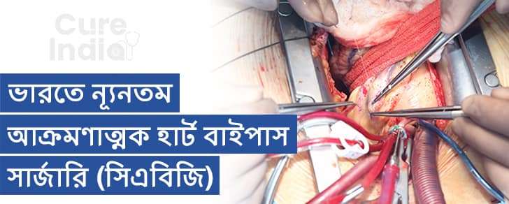 হার্ট বাইপাস সার্জারি